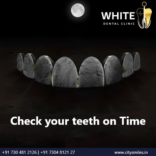 Check Your Teeth on Time with White Dental Clinic