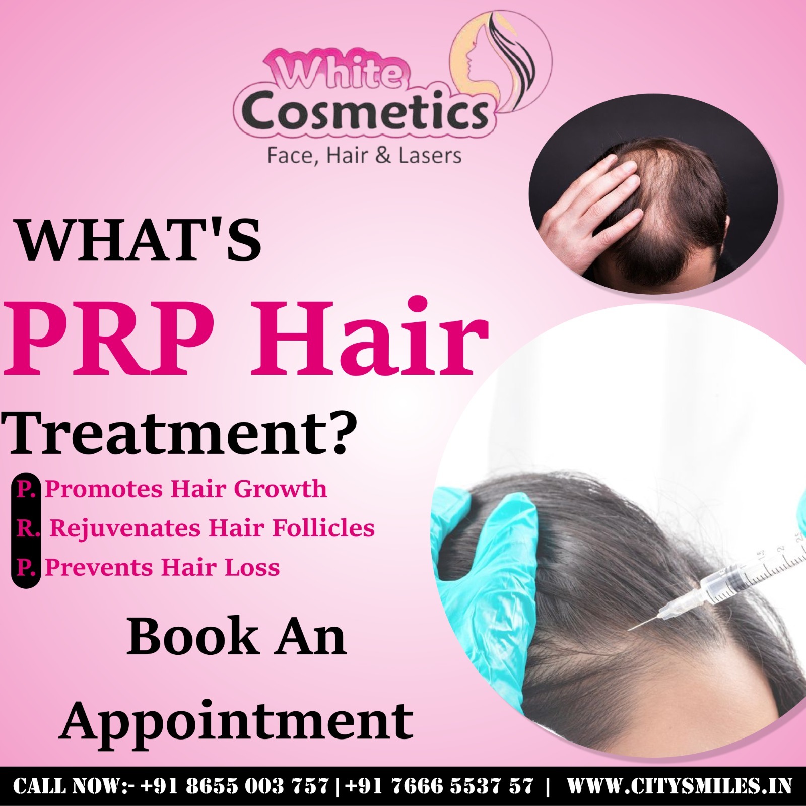  What’s PRP Hair Treatment? 