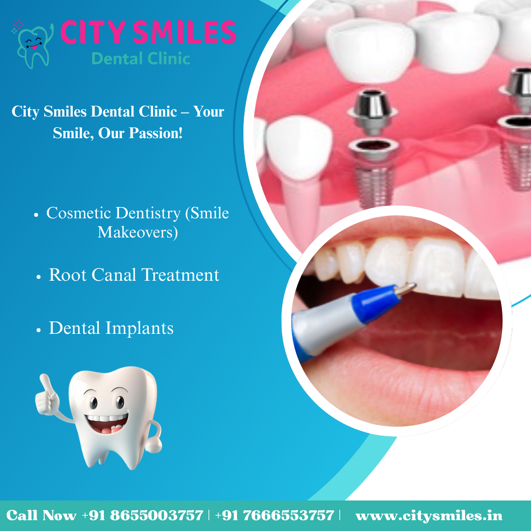  City Smiles Dental Clinic – Your Smile, Our Passion! 