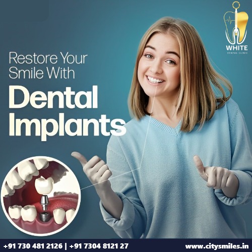 Restore Your Smile with Dental Implants at White Dental! 