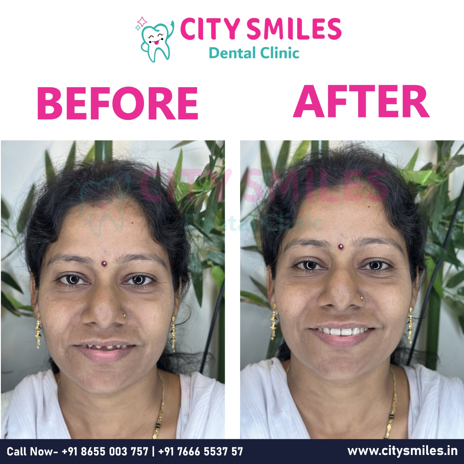 City Smiles Dental Clinic – Transforming Smiles, One Patient at a Time! 