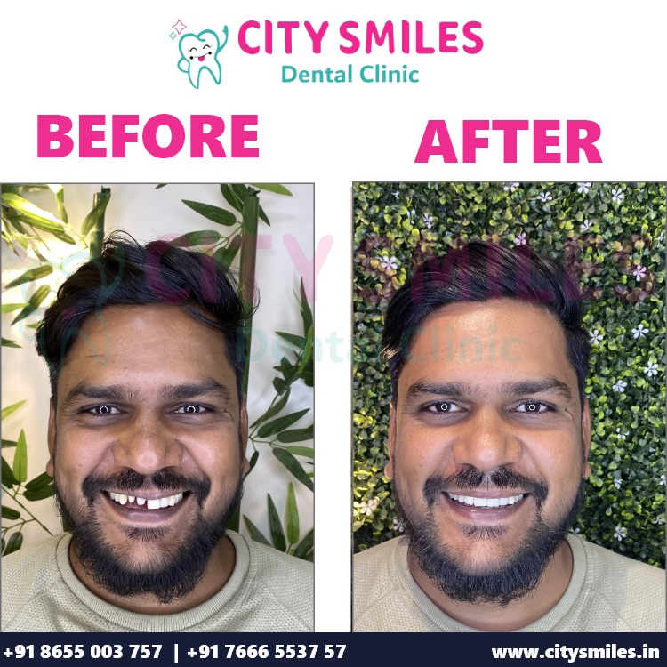 Transform Your Smile at CITY SMILES Dental Clinic! 