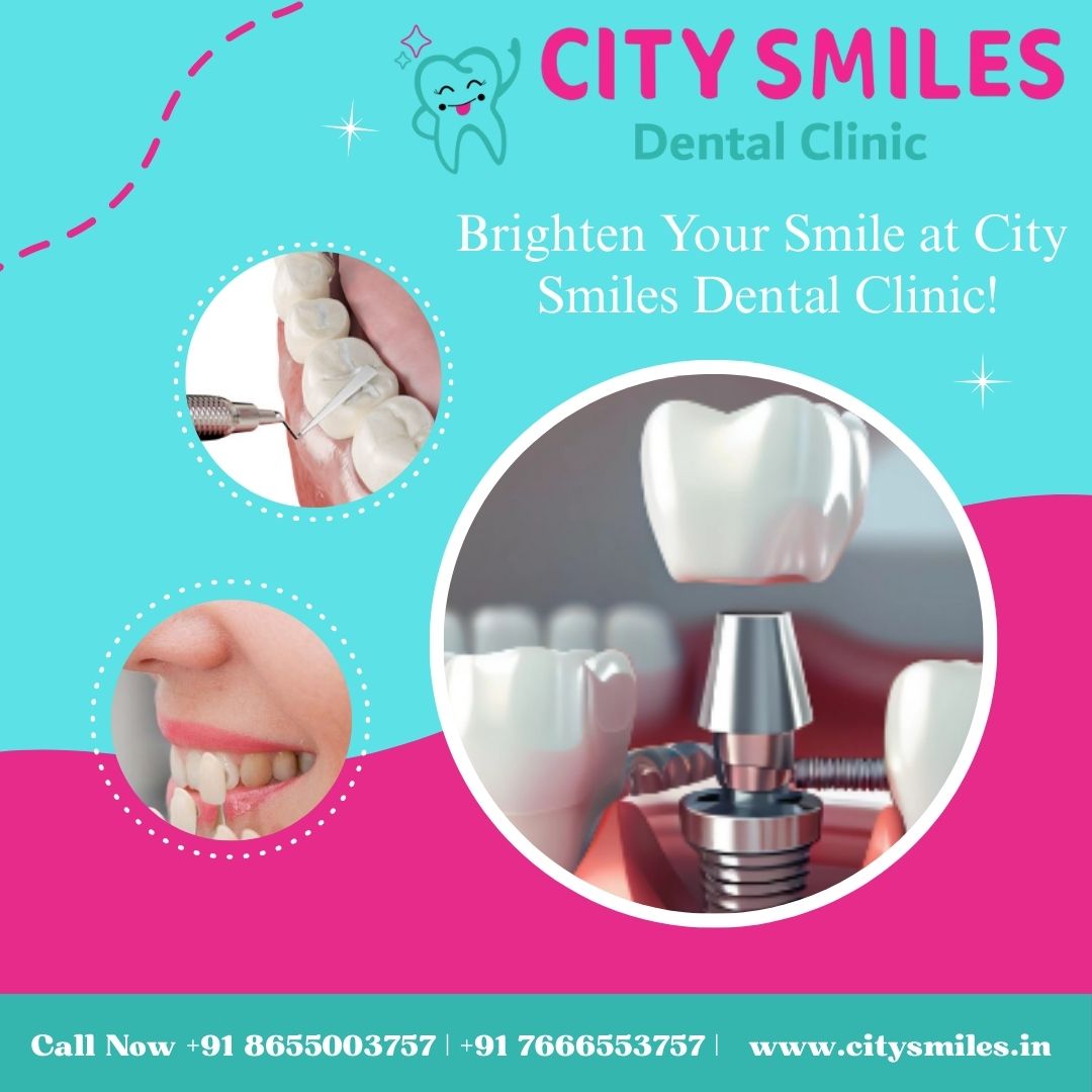  Brighten Your Smile with Confidence at City Smiles Dental Clinic! 