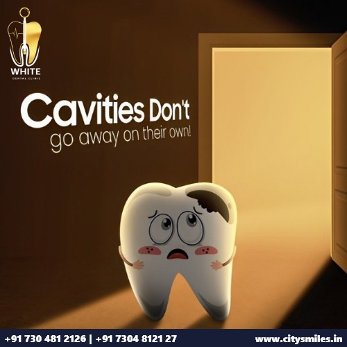 Say Goodbye to Cavities with Expert Care