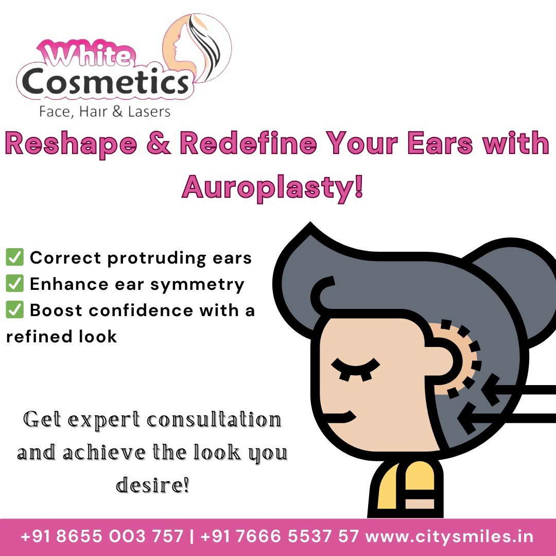  Reshape & Redefine Your Ears with Auroplasty! 