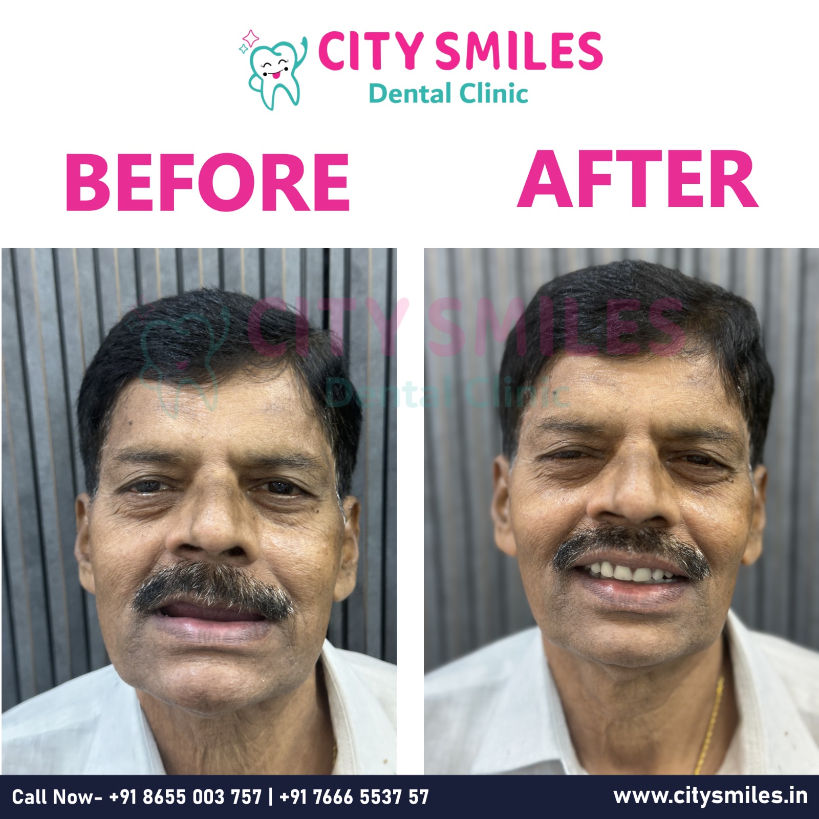 Smile Transformation in Navi Mumbai 