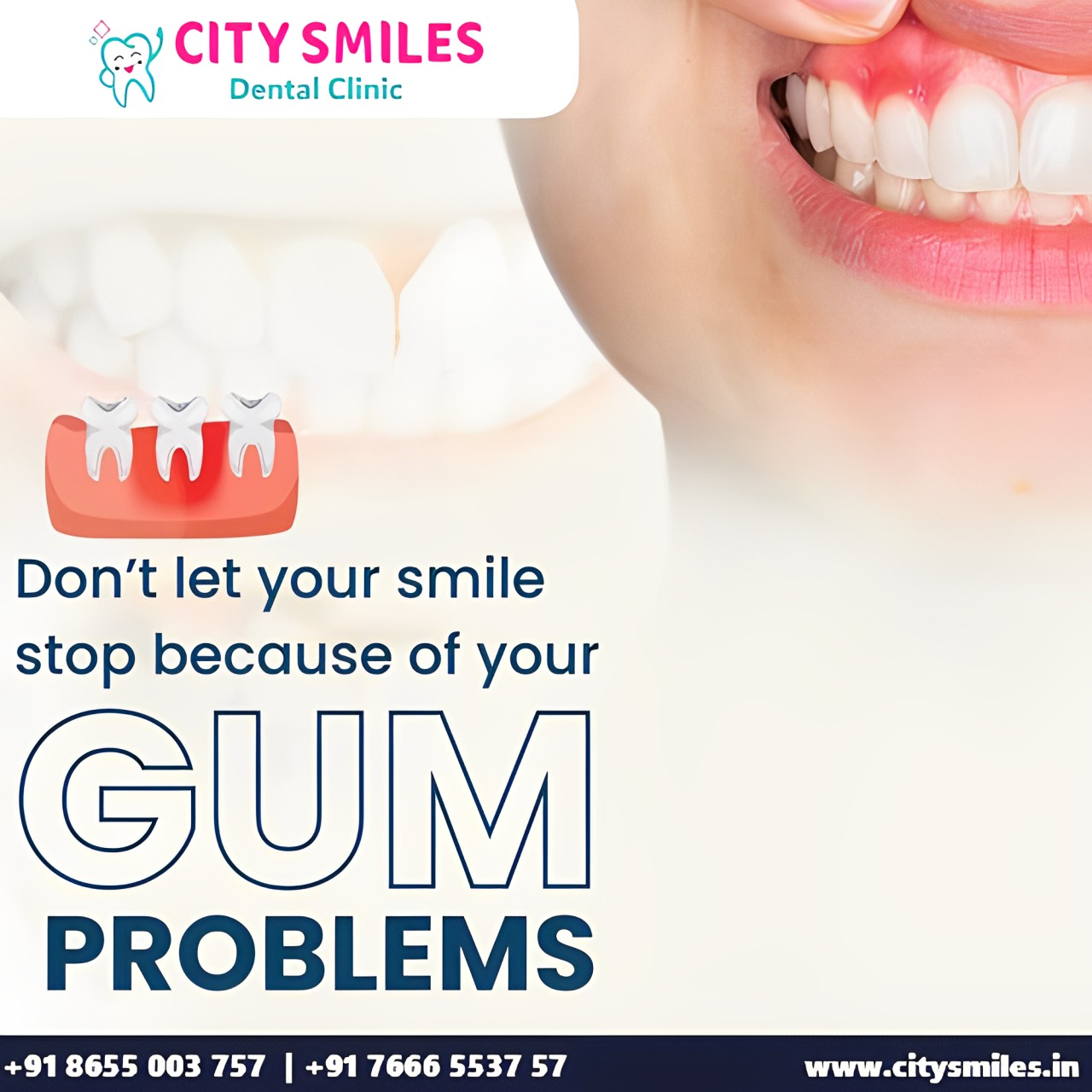 Don’t Let Gum Problems Dim Your Smile!