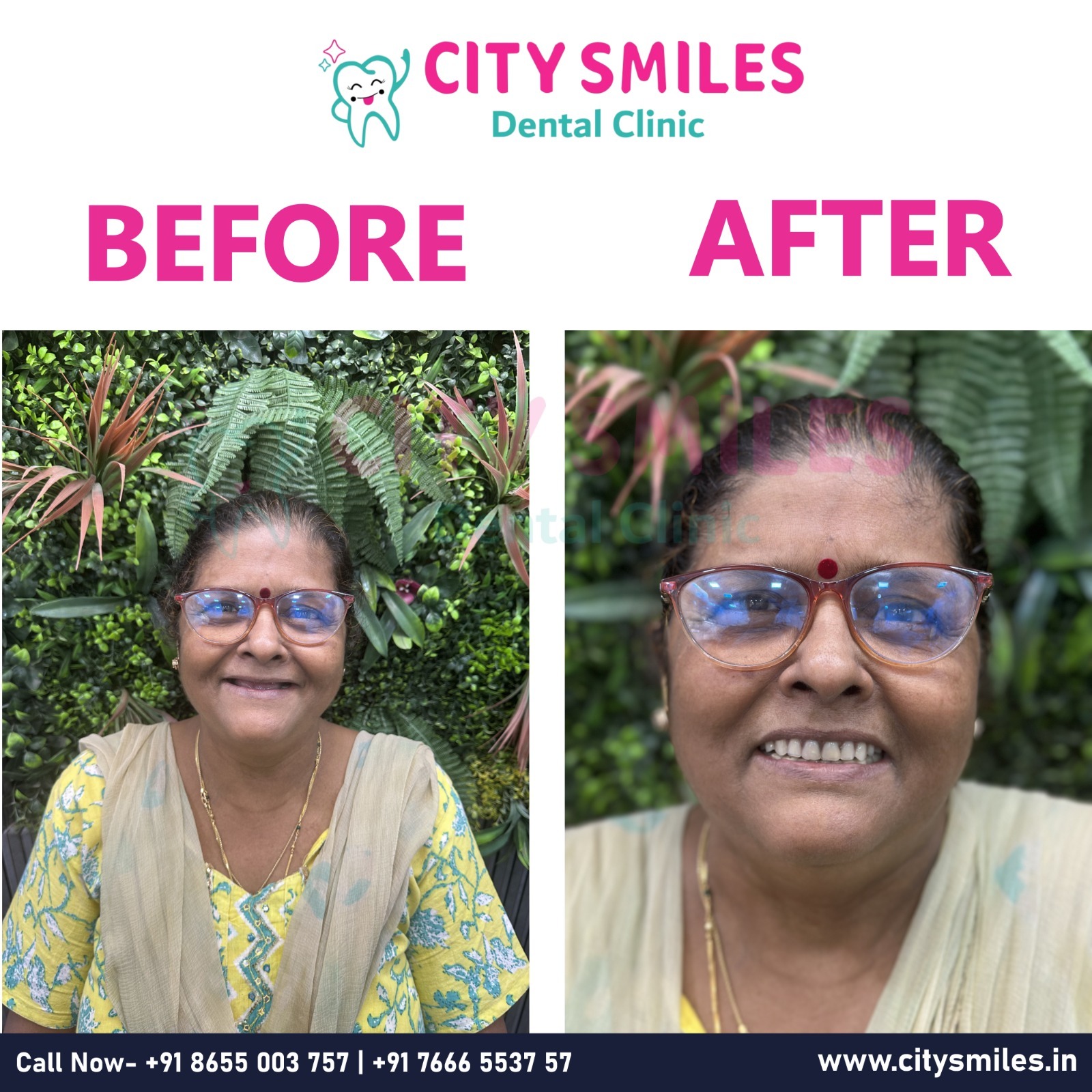 CITY SMILES Dental Clinic – Your Path to a Brighter Smile