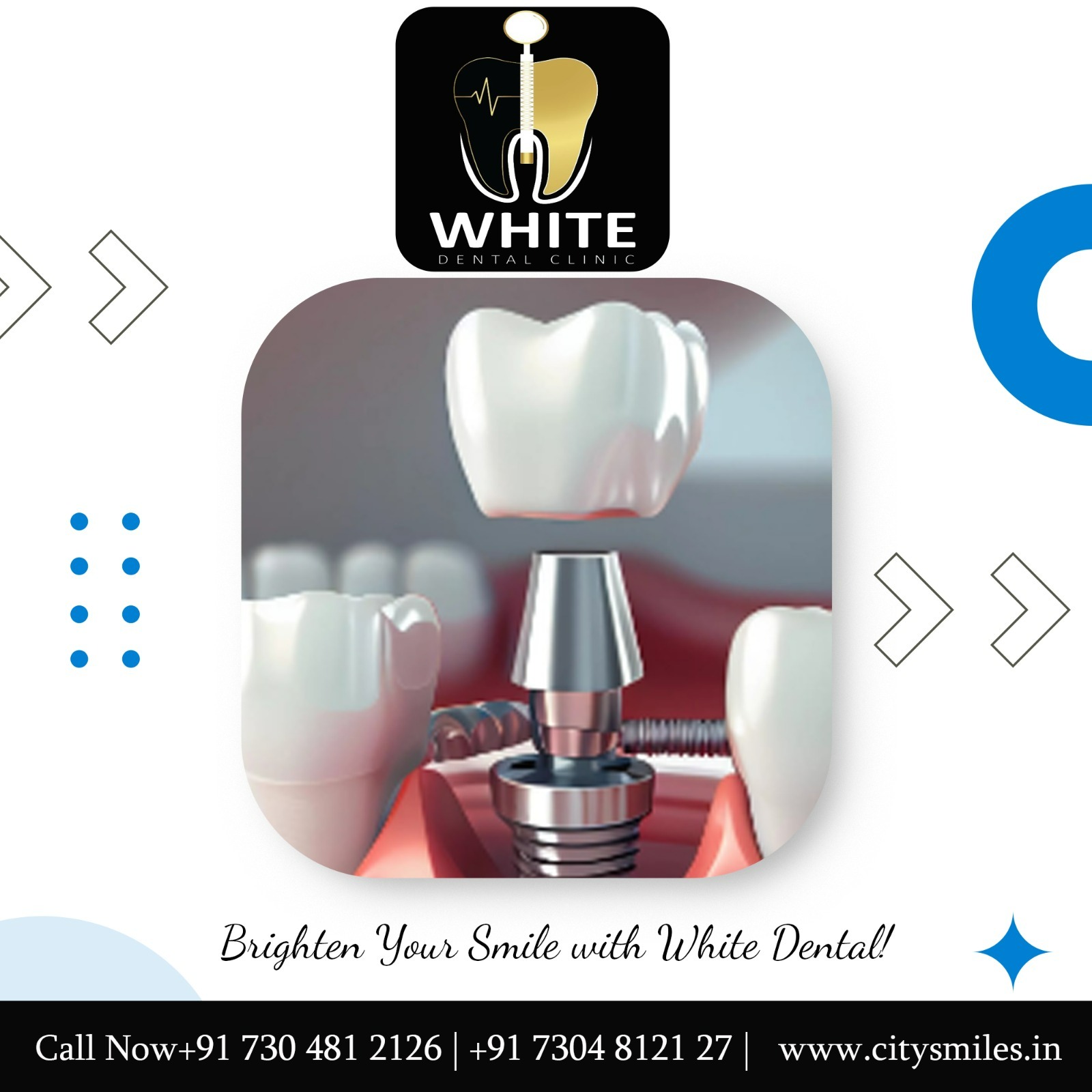 Your smile is our passion! At White Dental Clinic, we combine advanced technology with expert care to deliver exceptional dental solutions for you and your family.