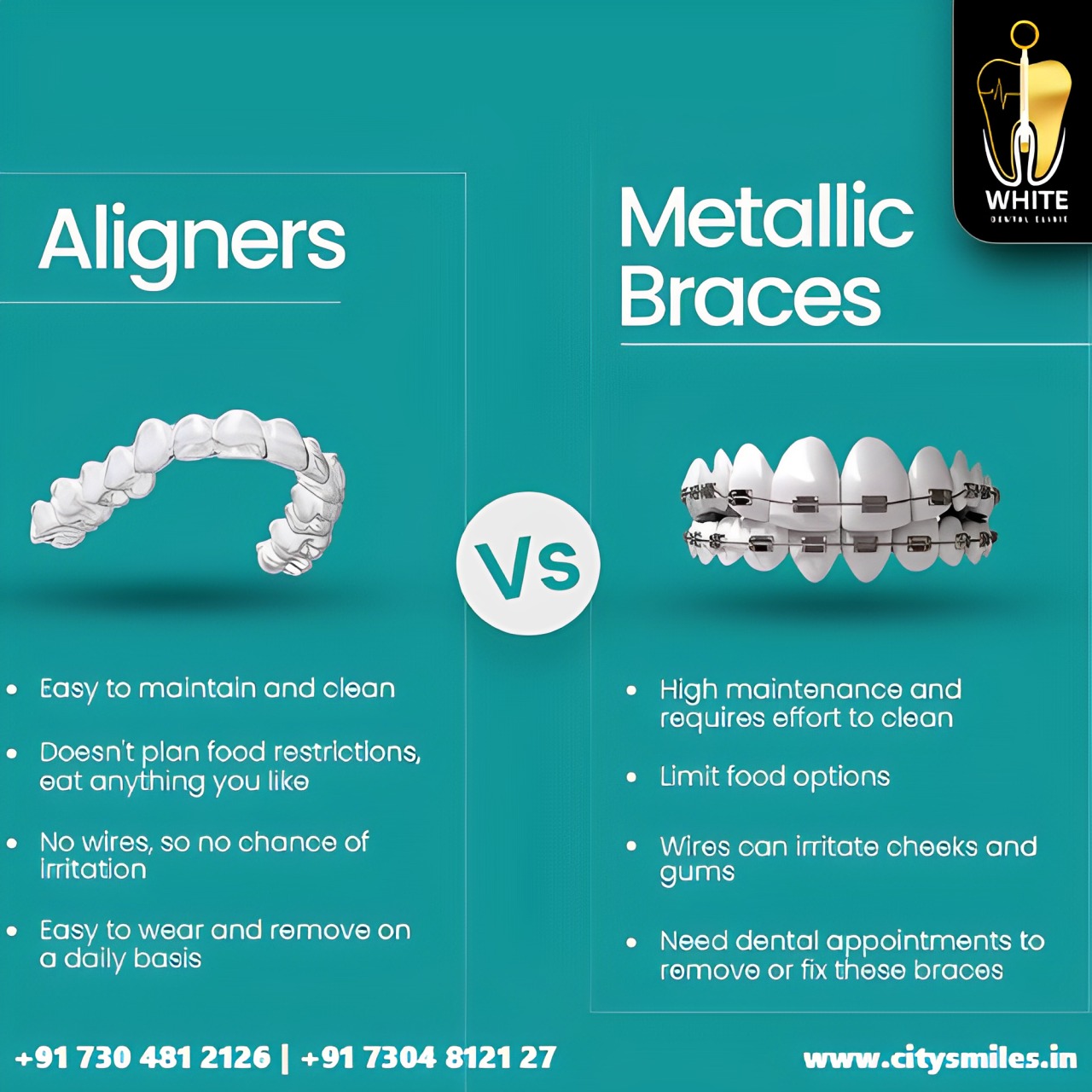 White Dental: Transform Your Smile with Aligners vs. Metallic Braces