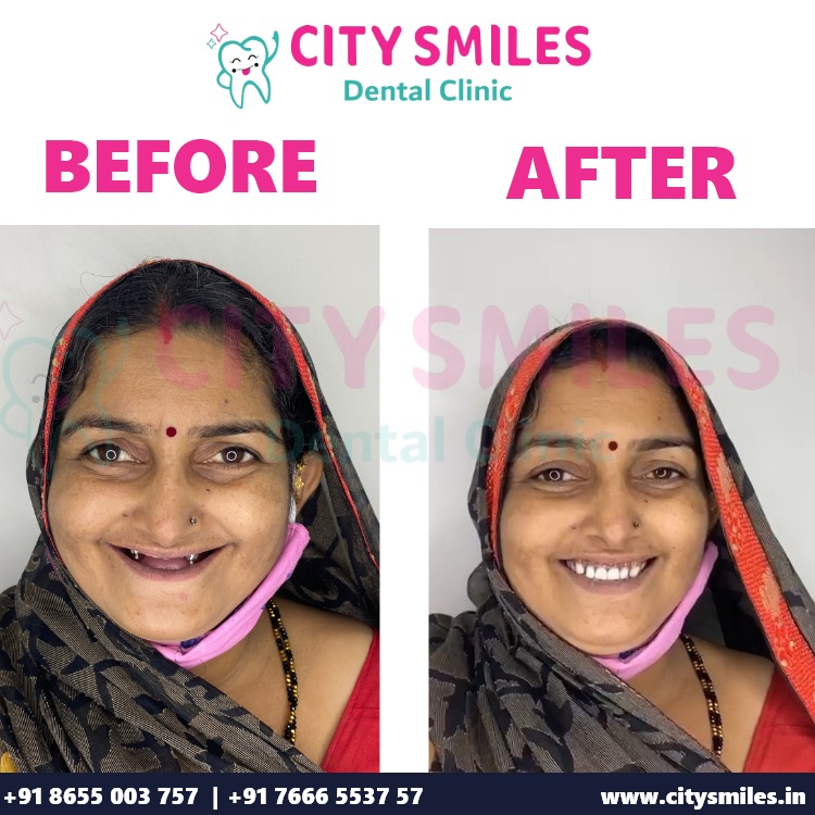 CITY SMILES Dental Clinic