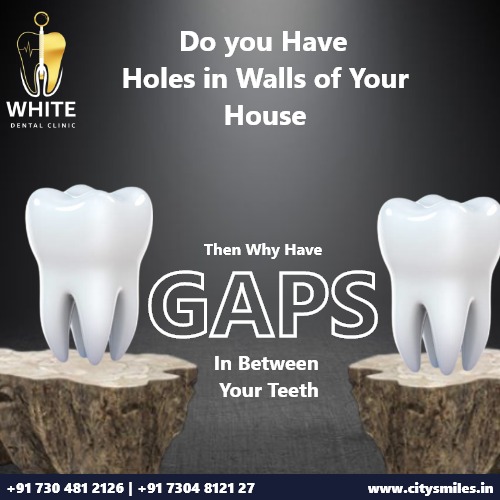 Do You Have Holes in the Walls of Your House? Why Have GAPS in Between Your Teeth?