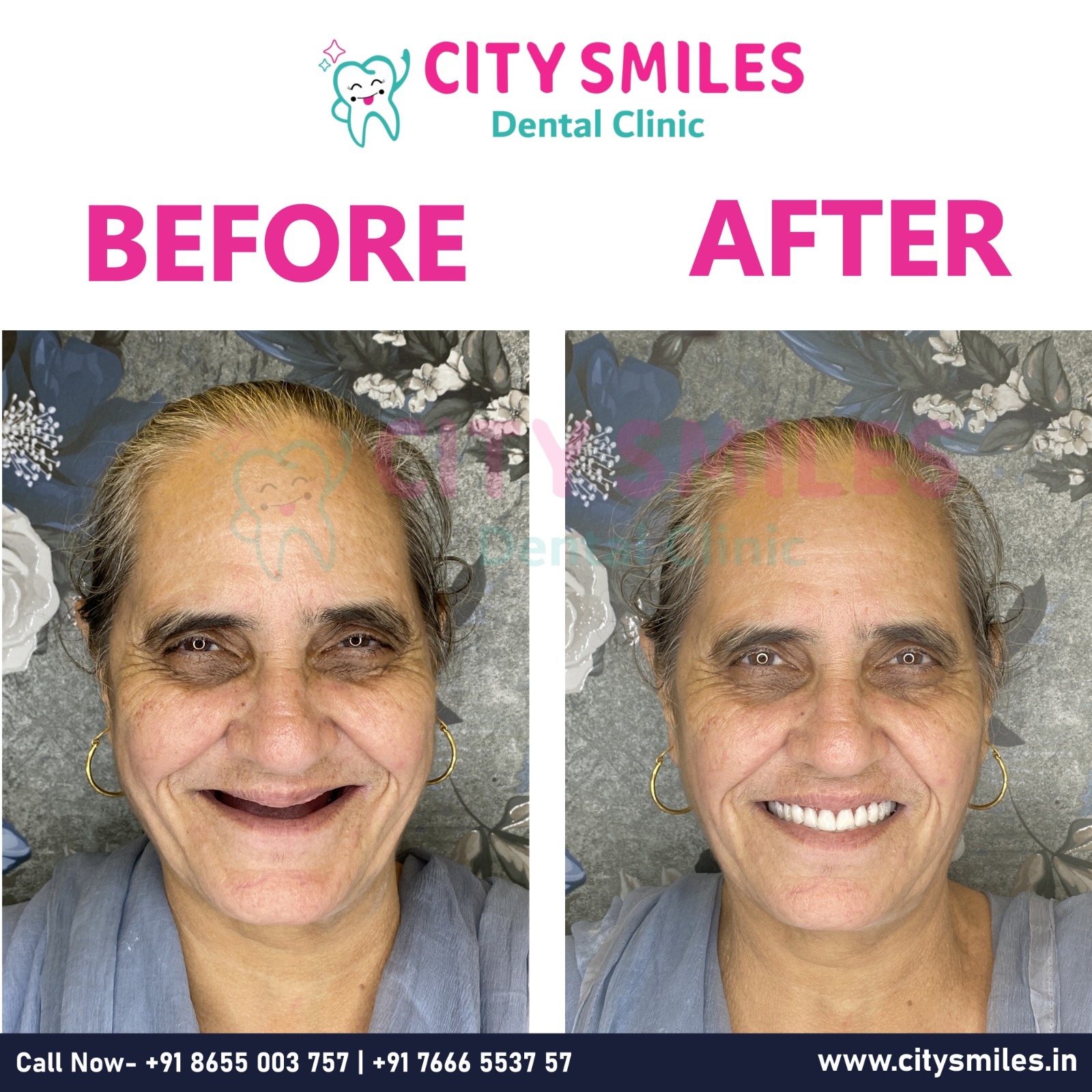 Transform Your Smile at CITY SMILES Dental Clinic – Where Every Smile Matters