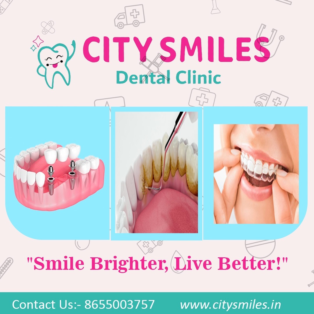 Transform Your Smile with City Smiles Dental Clinic!