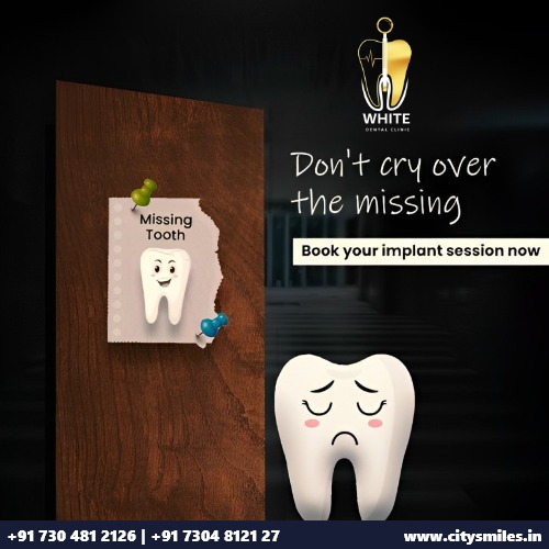 Don't Cry Over Missing Teeth, Book Your Implant Session Today!