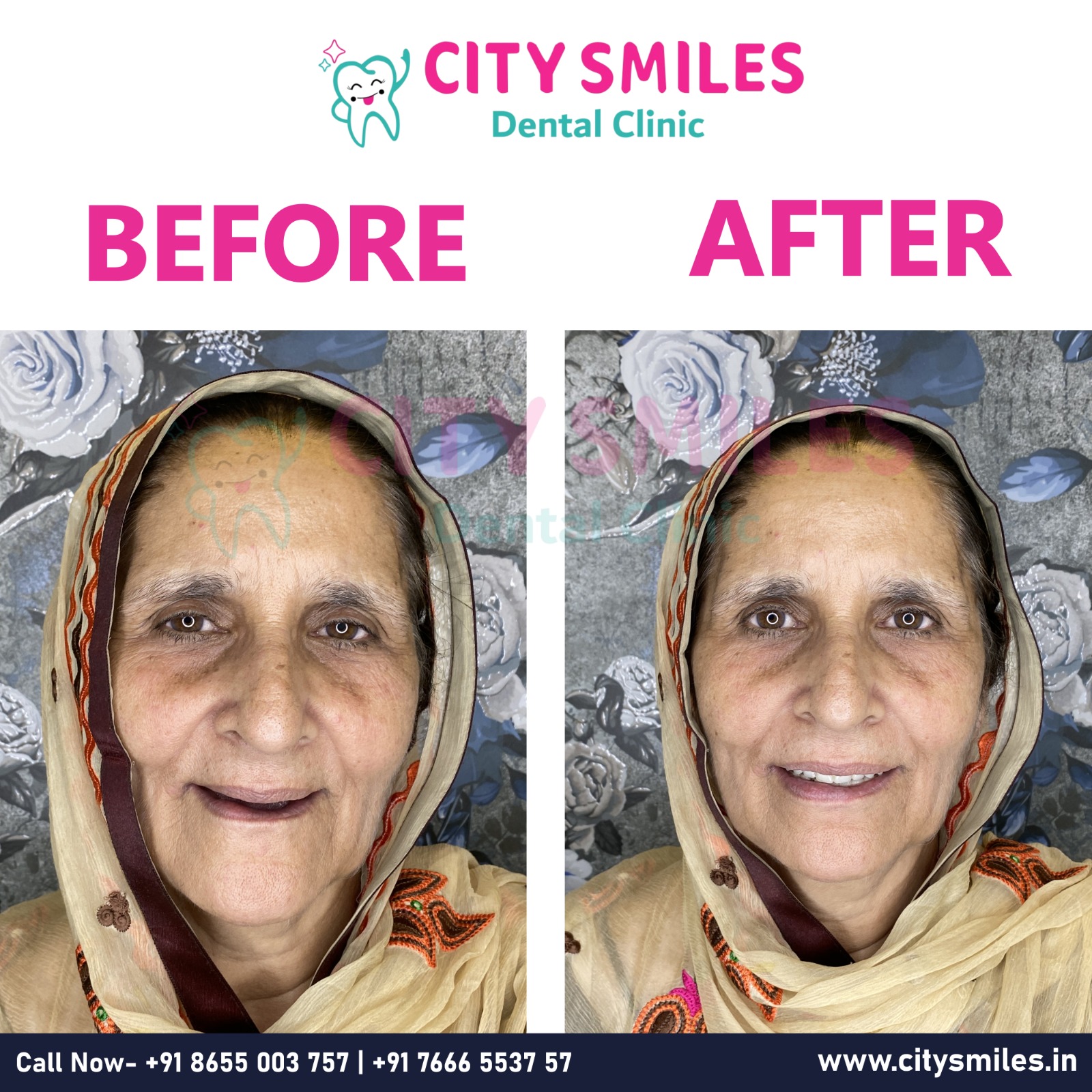 City Smiles Dental Clinic – Transforming Smiles, One Patient at a Time