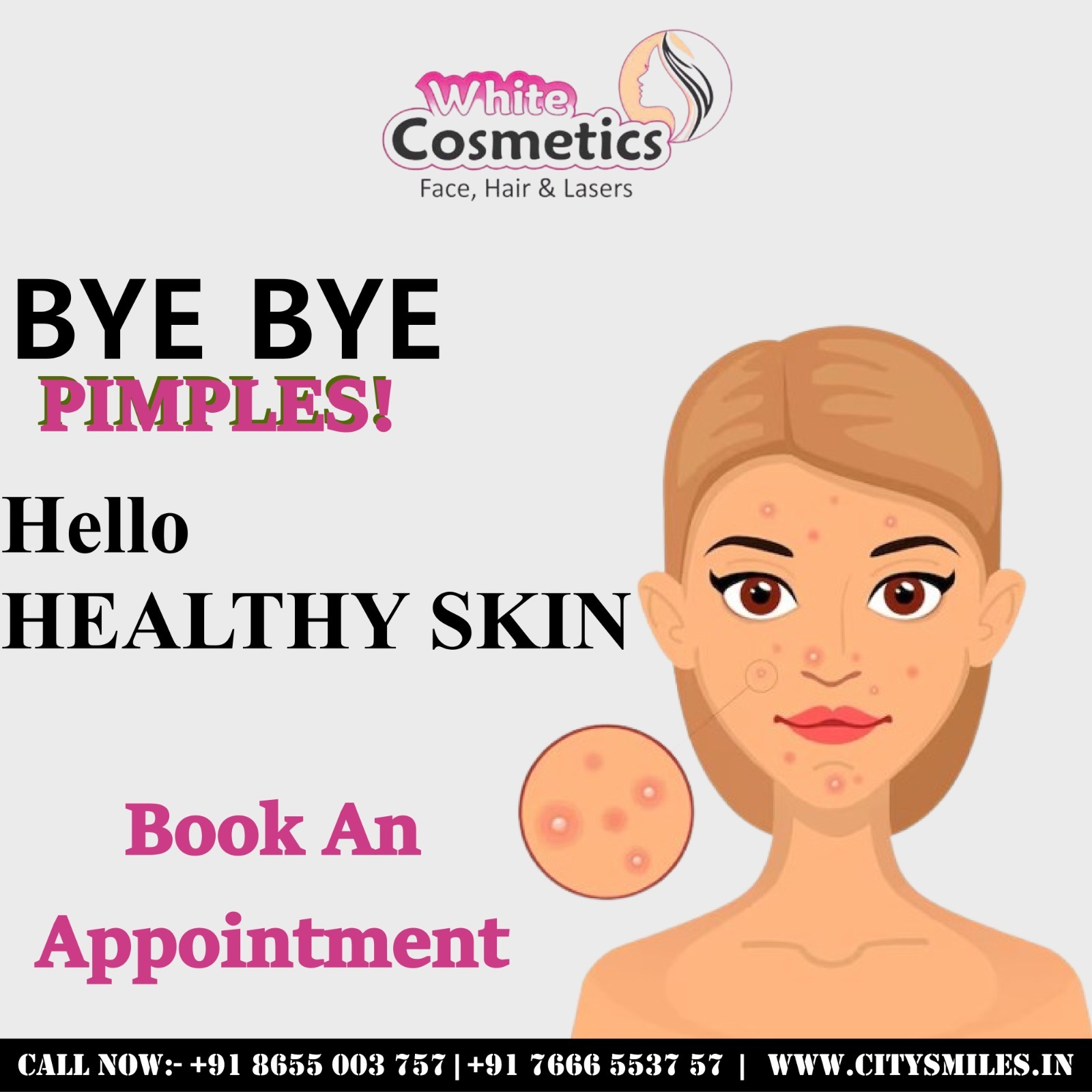 BYE BYE PIMPLES! Hello HEALTHY SKIN
