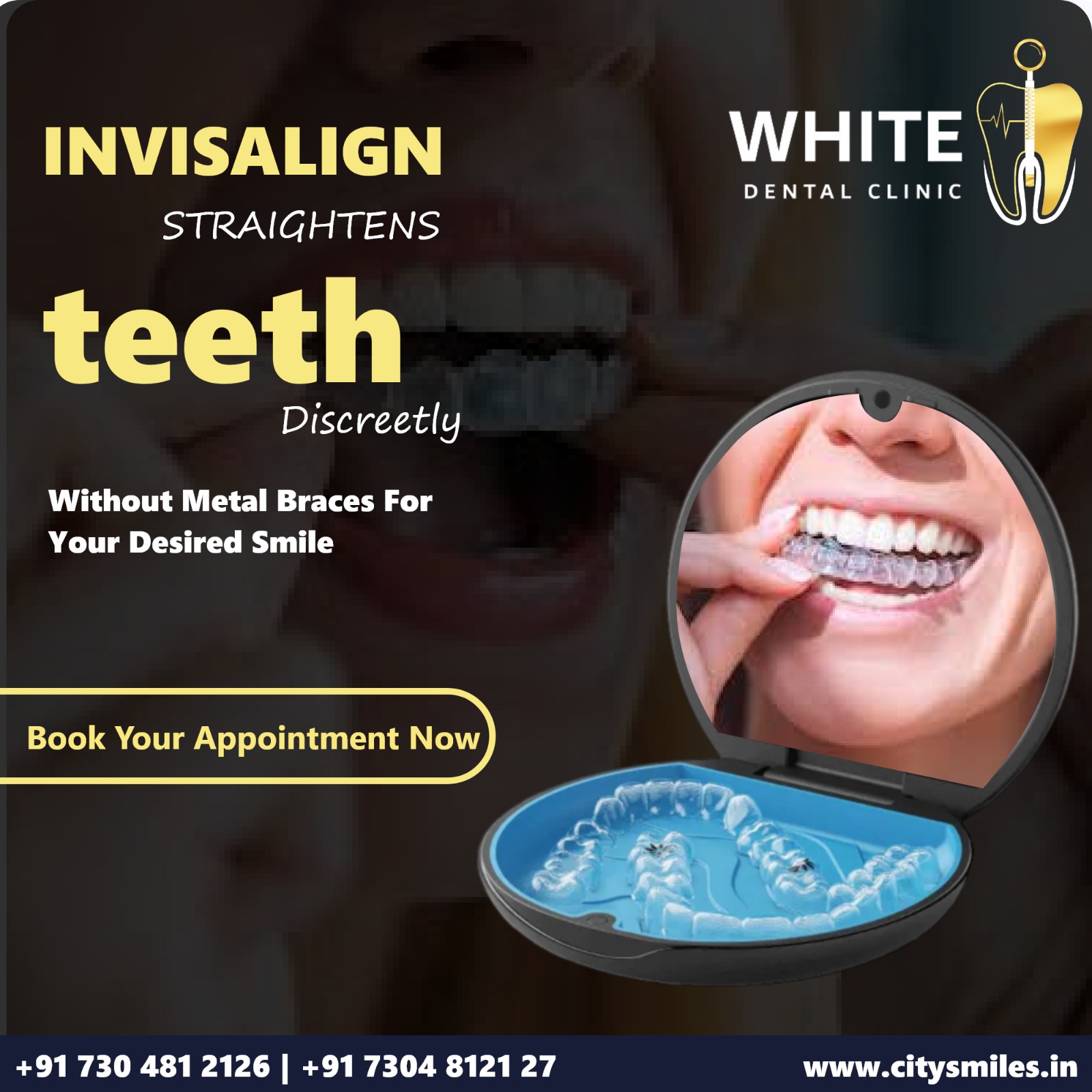 Achieve a Perfect Smile with Invisalign