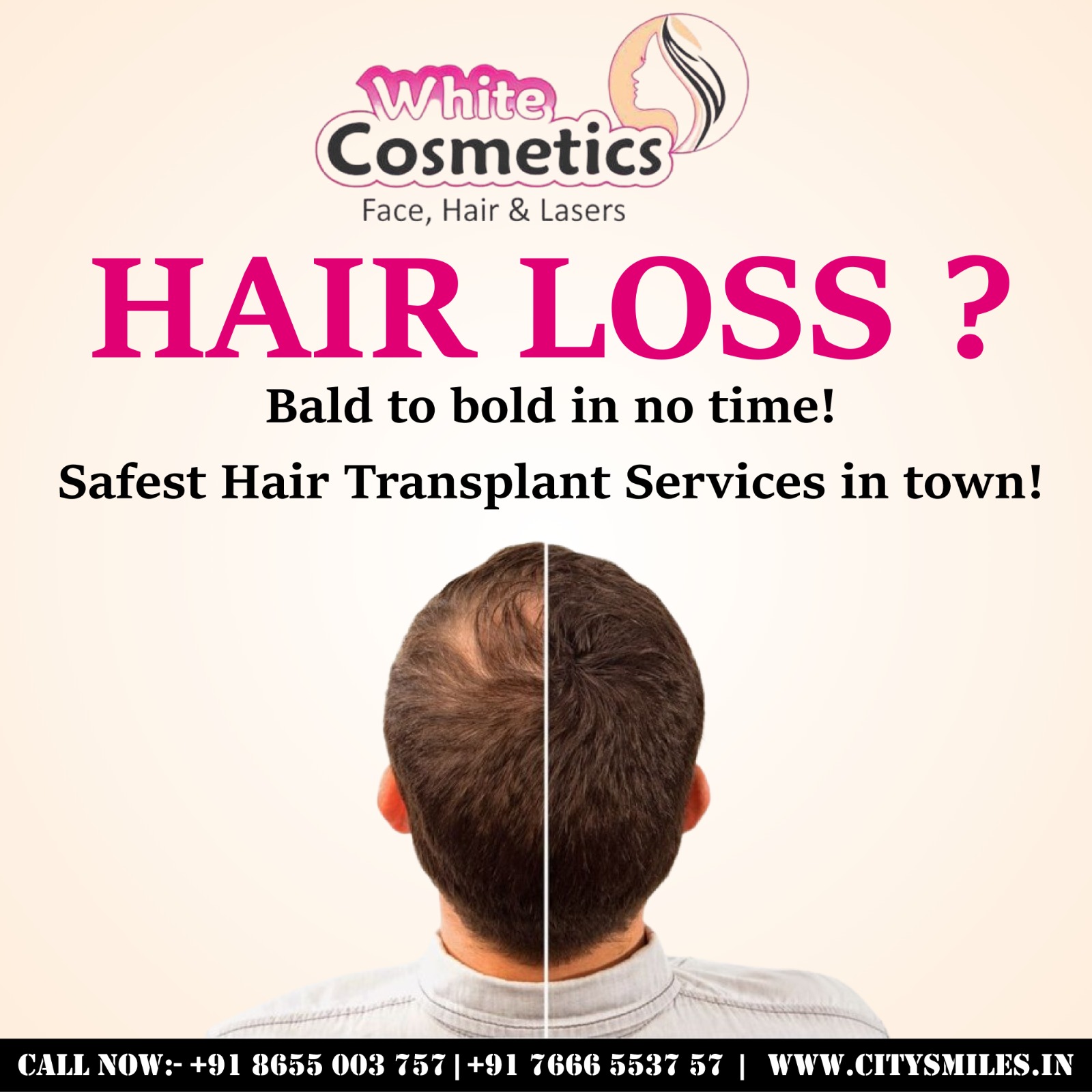Say Goodbye to Hair Loss with White Cosmetics!