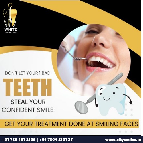 Don’t Let One Bad Tooth Steal Your Confident Smile! 