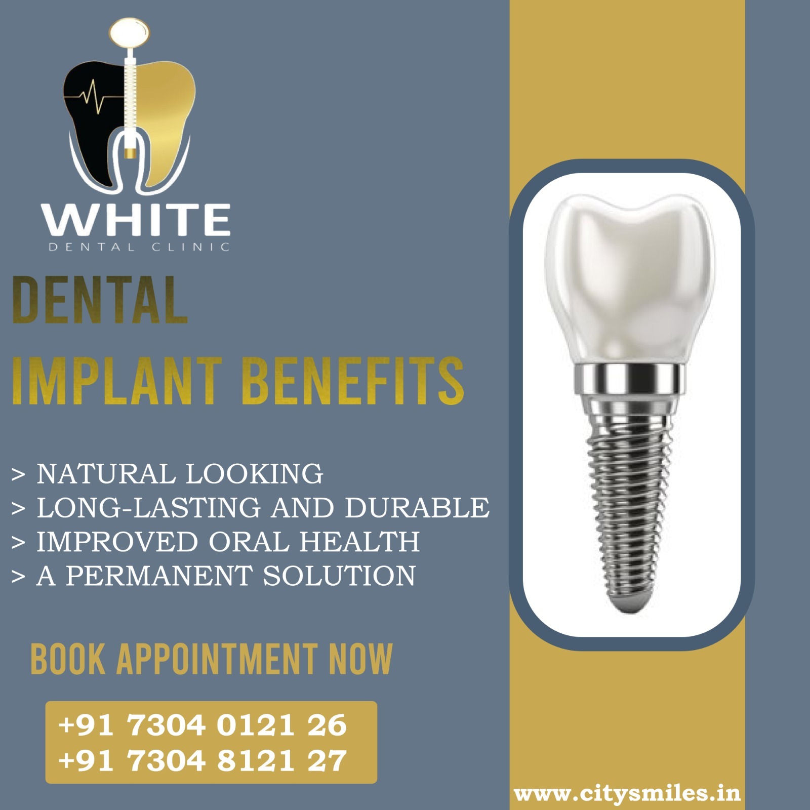 White Dental Clinic – Discover the Benefits of Dental Implants!