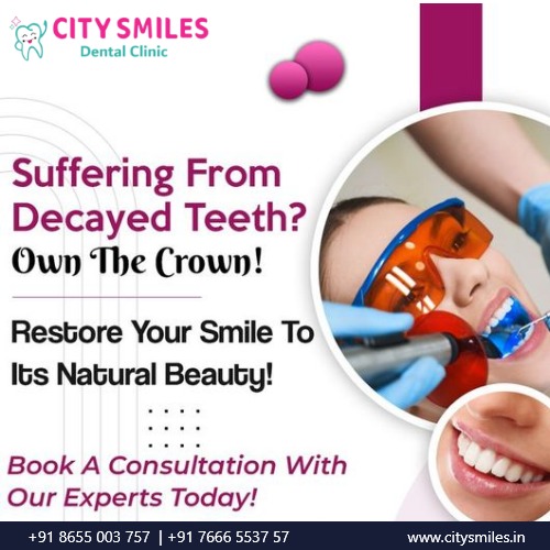 Restore Your Smile with Dental Crowns at City Smiles Dental Clinic, Navi Mumbai