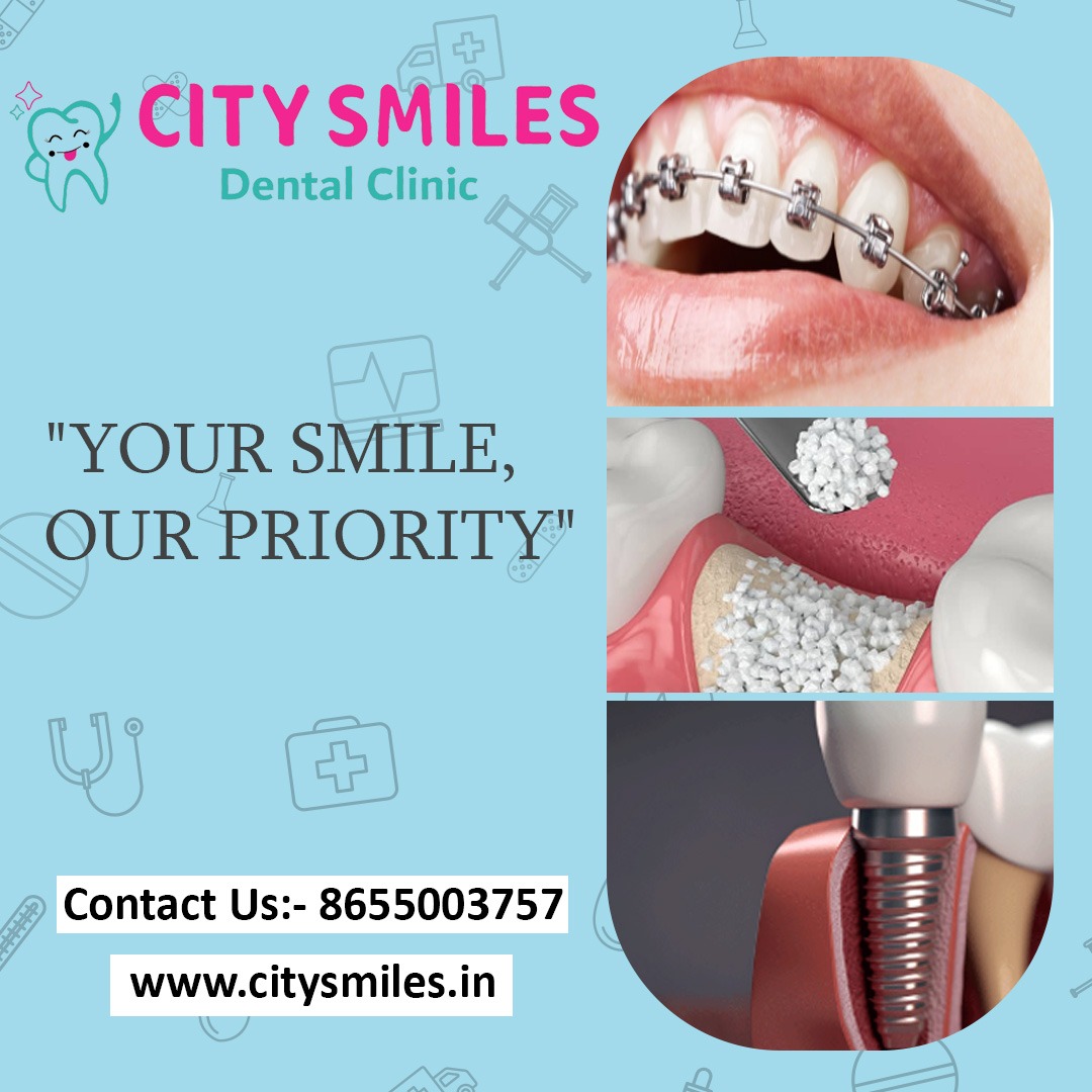 City Smile Dental Clinic – "YOUR SMILE, OUR PRIORITY"
