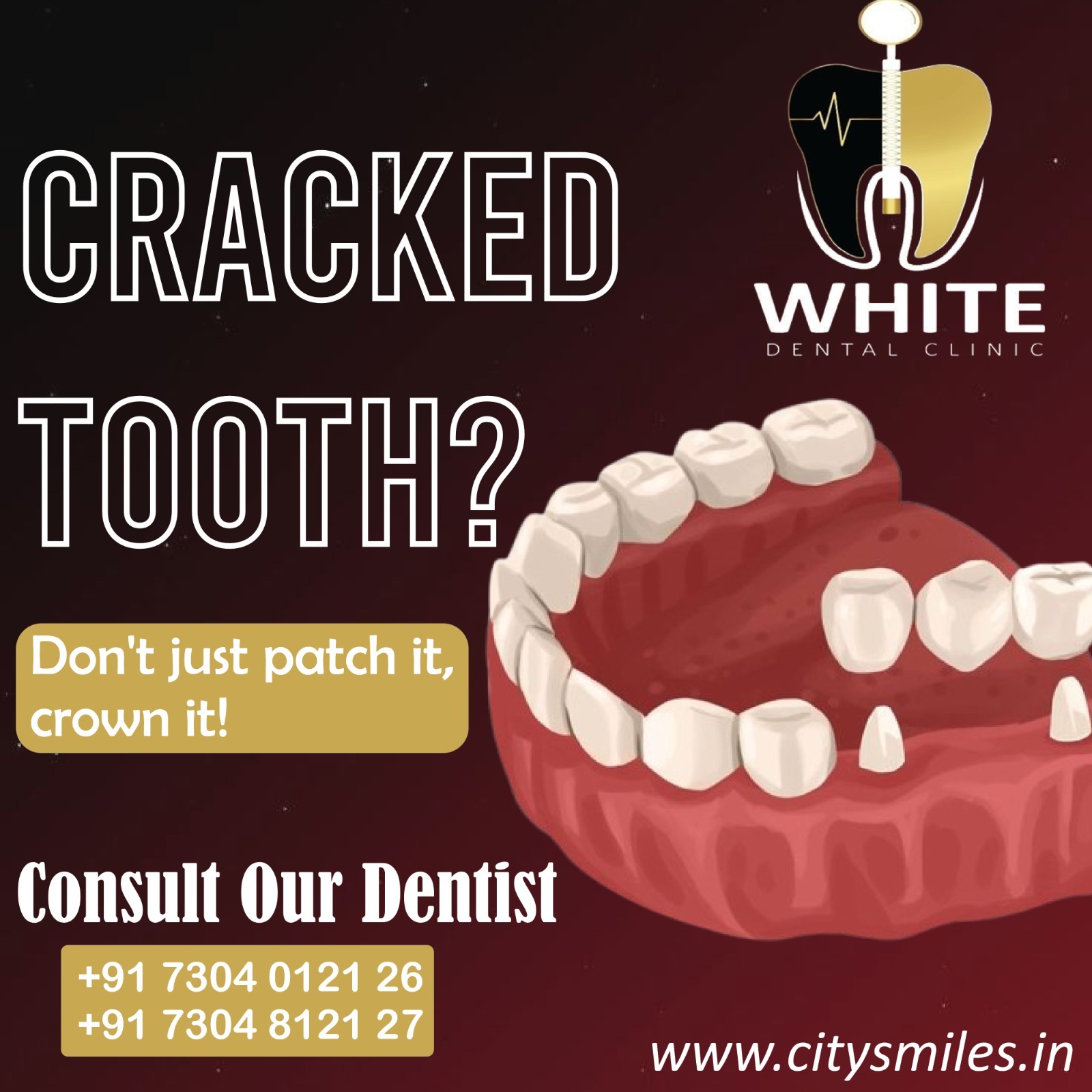 Cracked Tooth? Visit White Dental Clinic for Expert Care