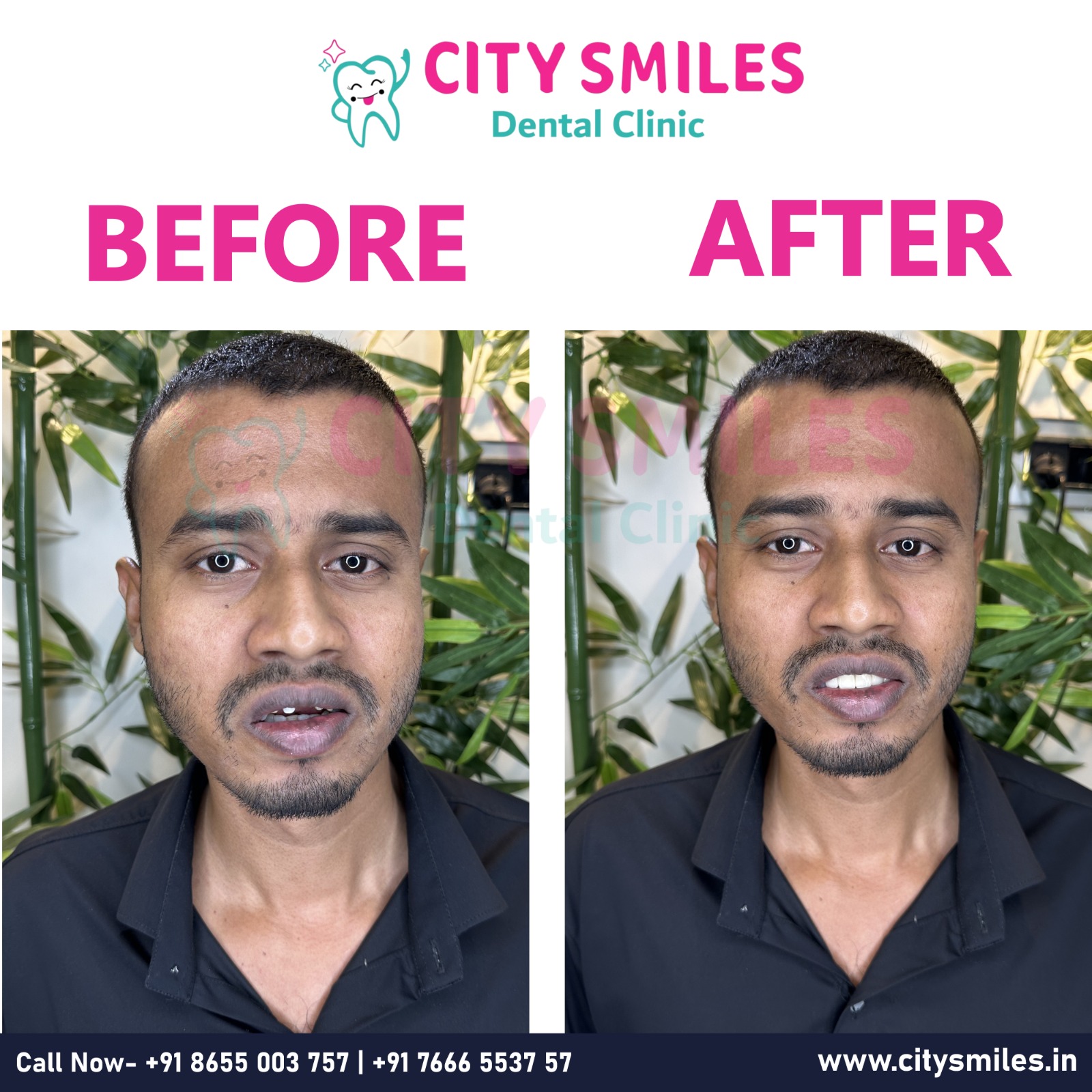 Transform Your Smile with CITY SMILES Dental Clinic!