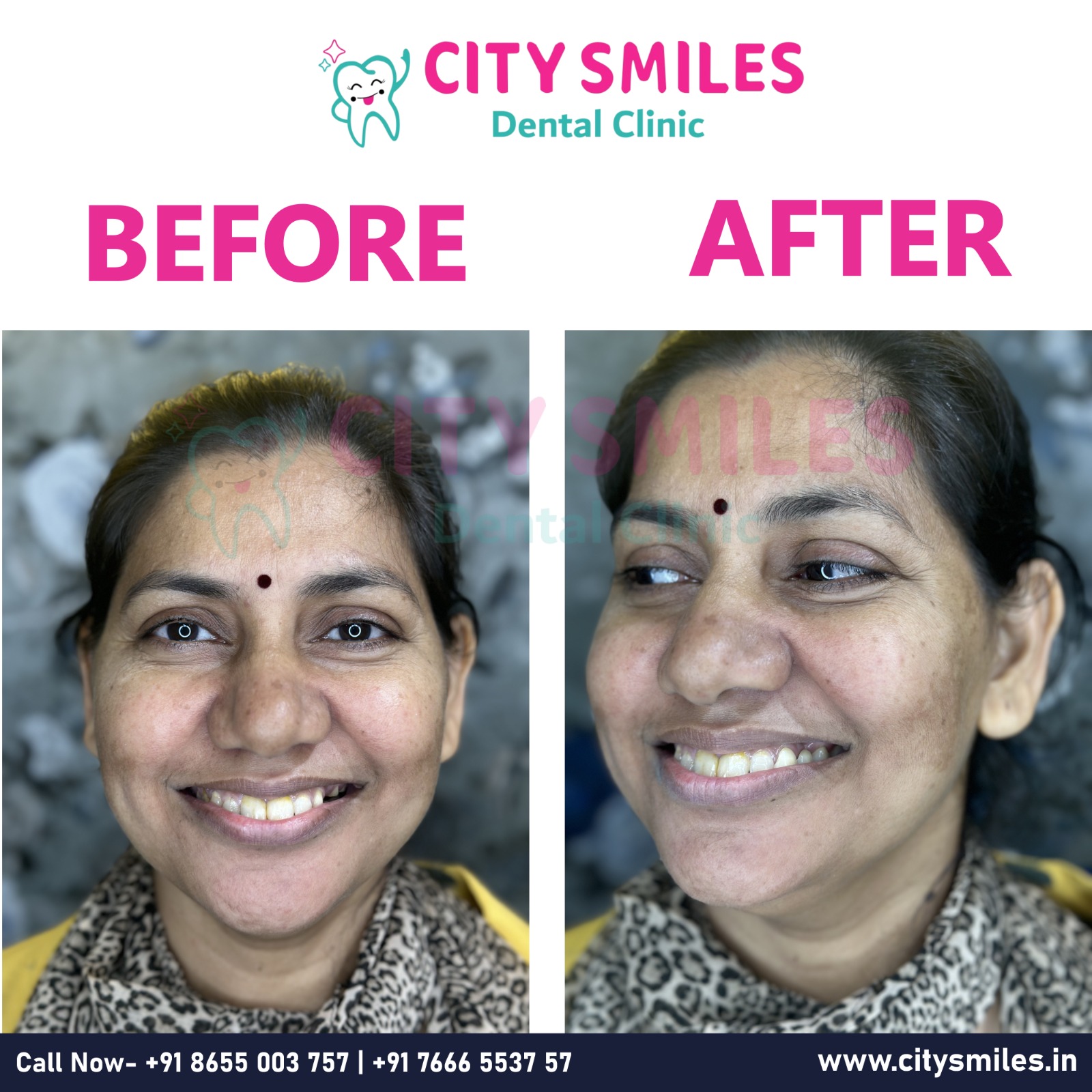  Transform Your Smile with CITY SMILES Dental Clinic! 