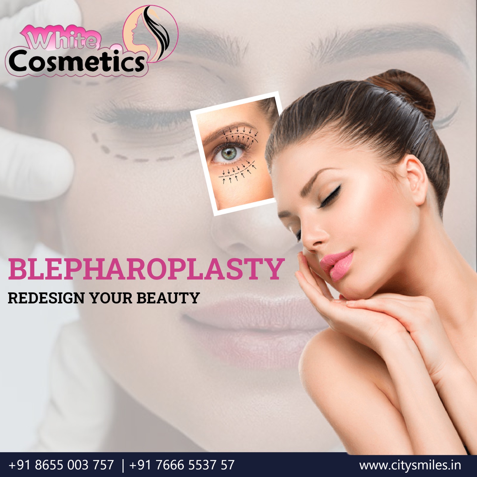 Redesign Your Beauty with Blepharoplasty at White Cosmetics