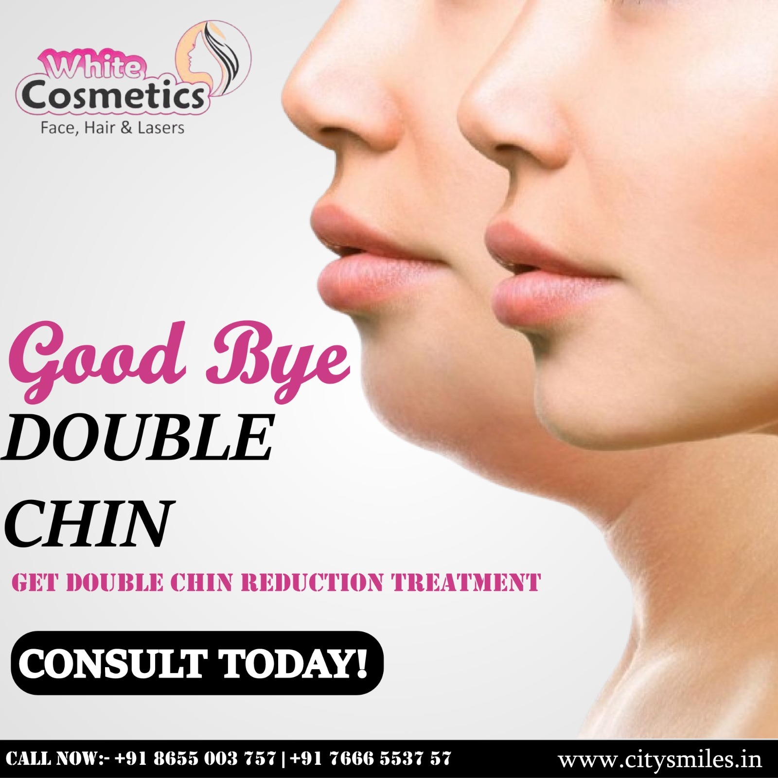 White Cosmetics – Goodbye Double Chin with Our Expert Treatments! 