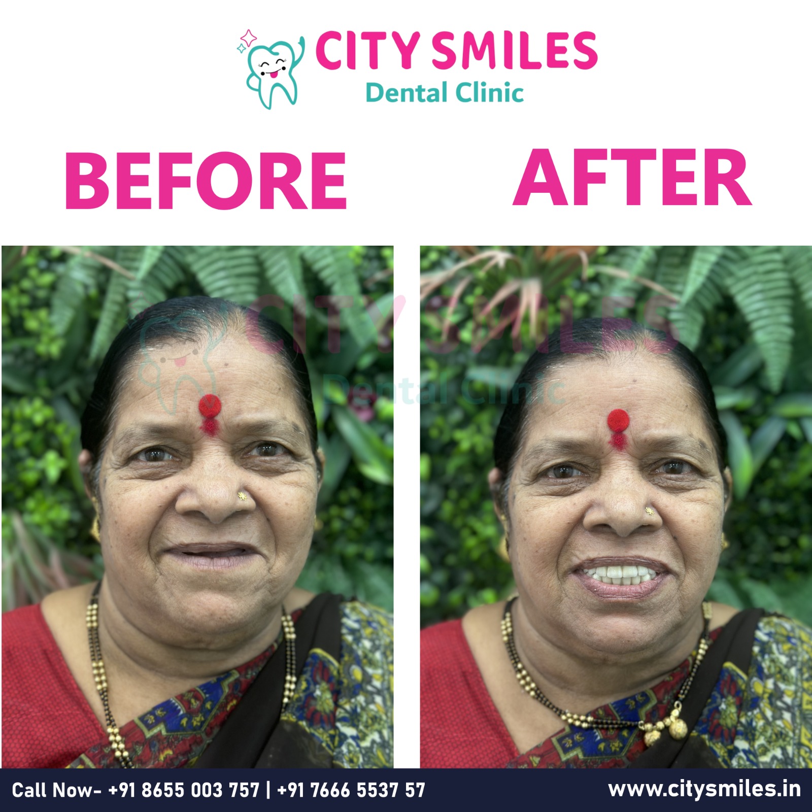 City Smiles Dental Clinic – Your Path to a Beautiful Smile