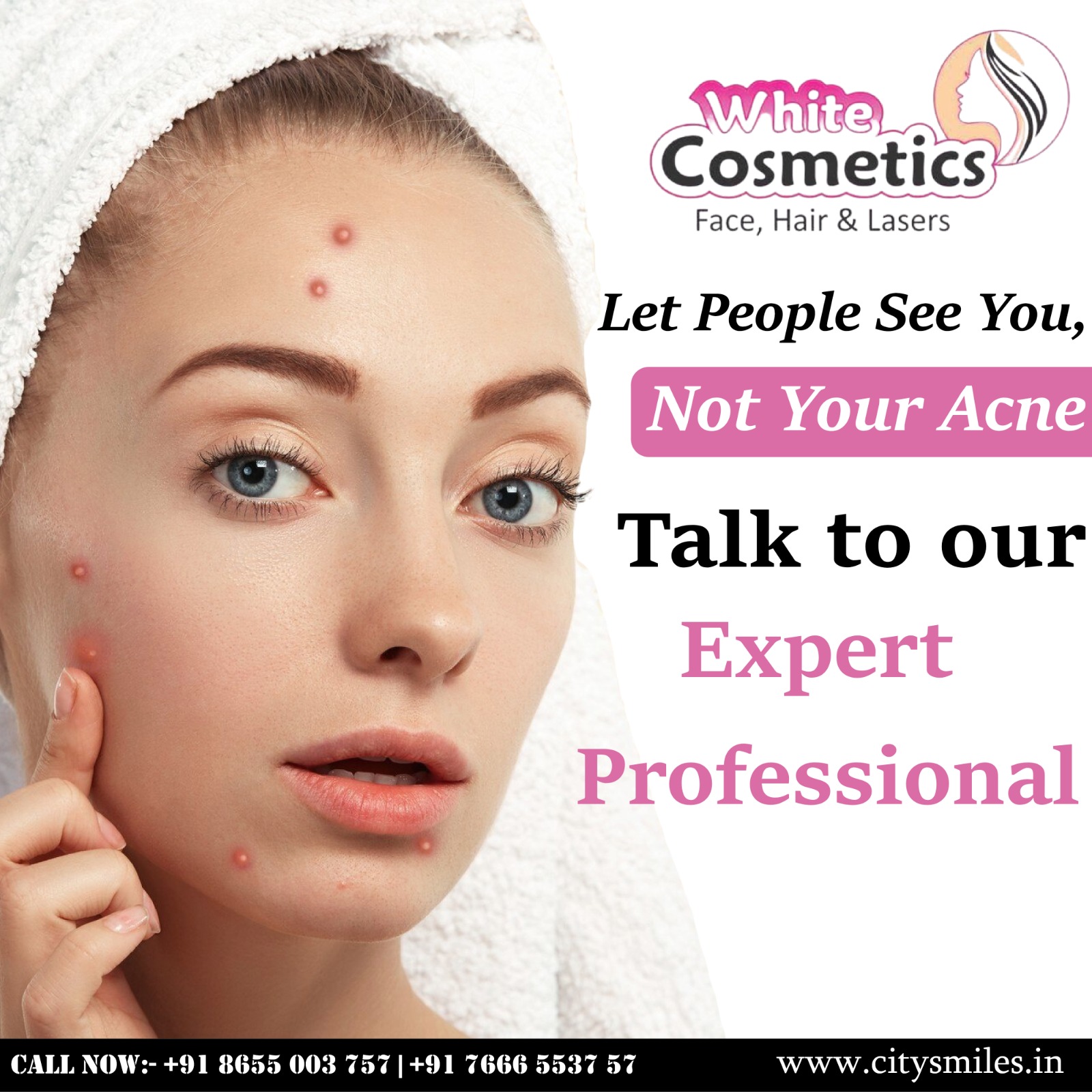 Let People See You, Not Your Acne!