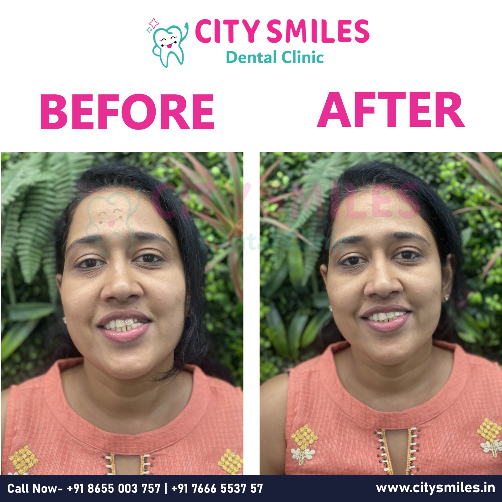  City Smiles Dental Clinic – Your Path to a Brighter Smile 