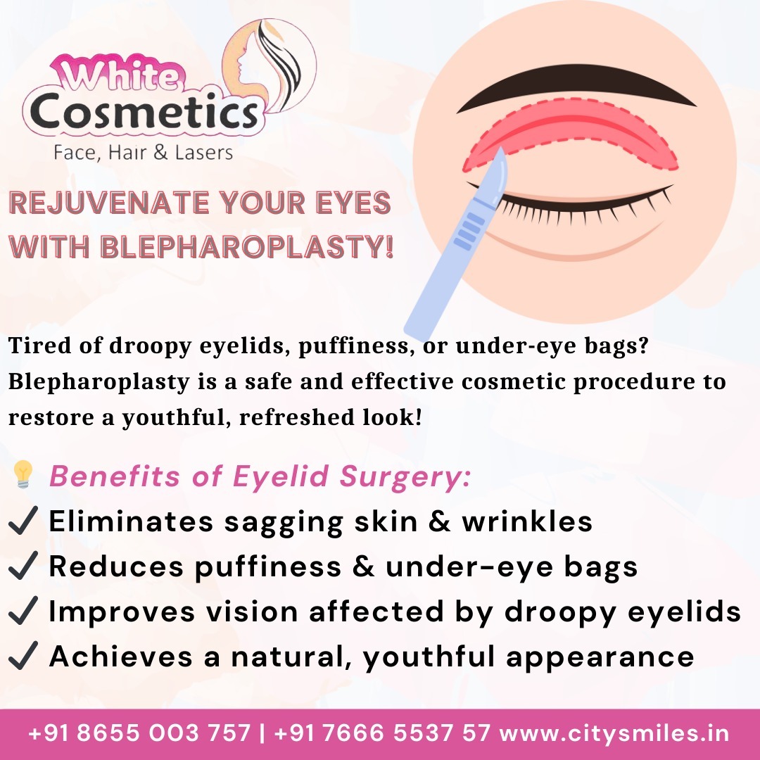 ✨ Rejuvenate Your Eyes with Blepharoplasty at White Cosmetics!