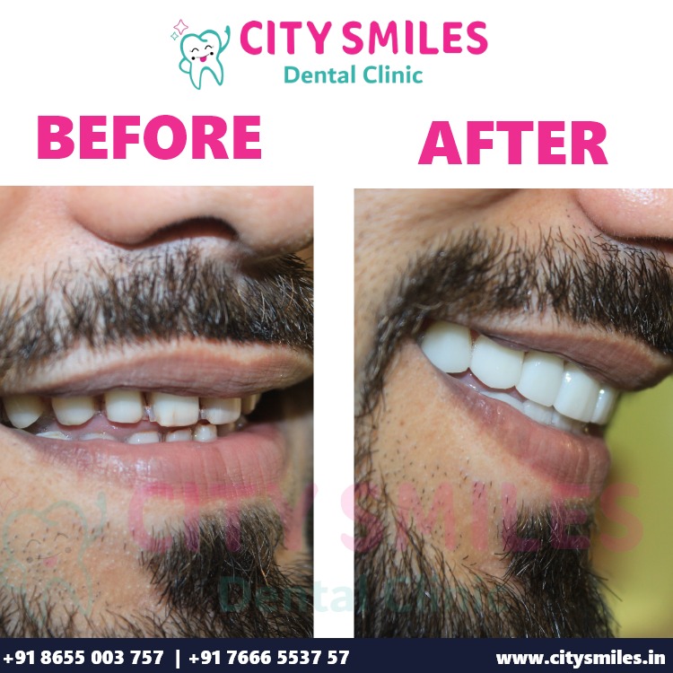 Transform Your Smile with CITY SMILES Dental Clinic!