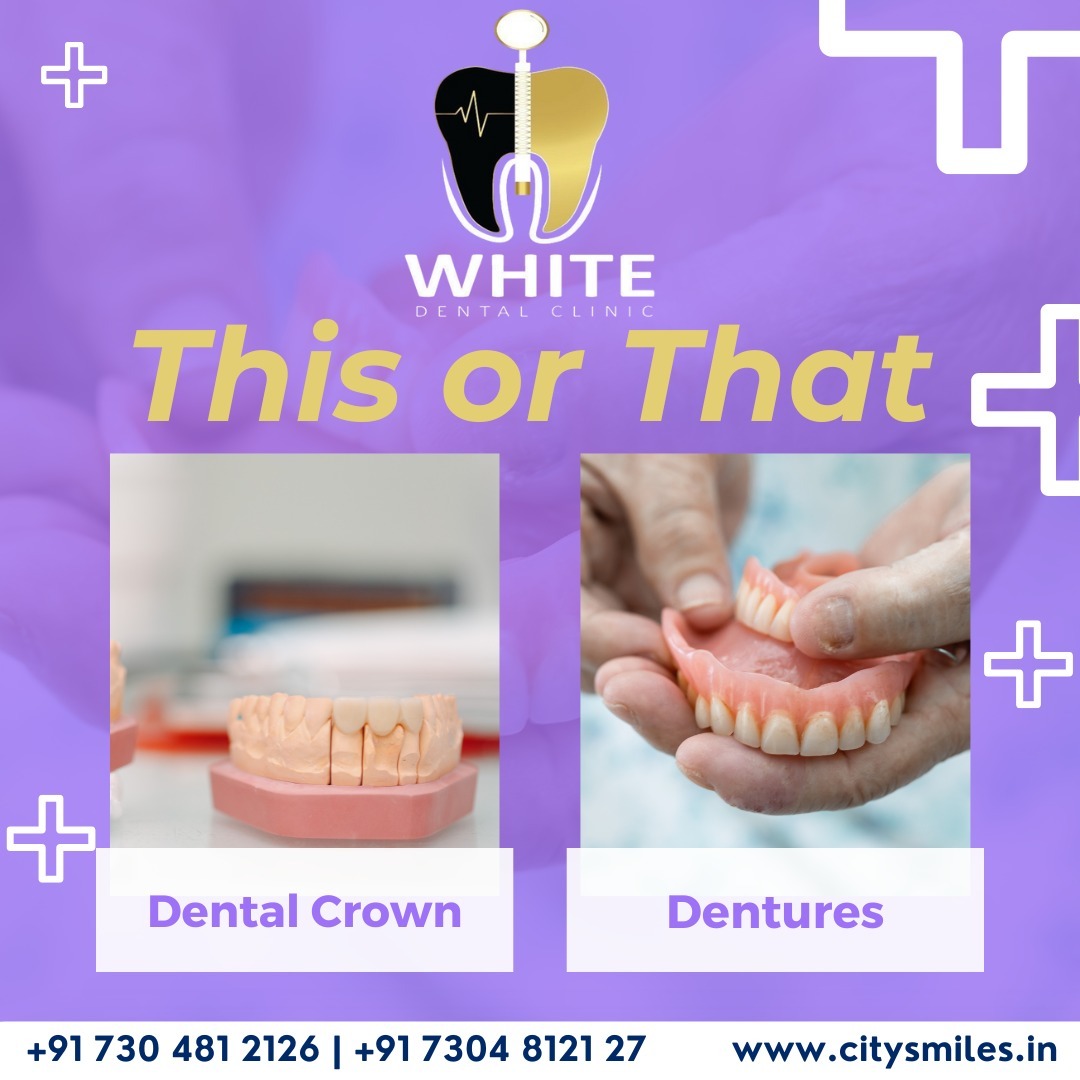  Dental Crown or Dentures? Which One is Right for You? 