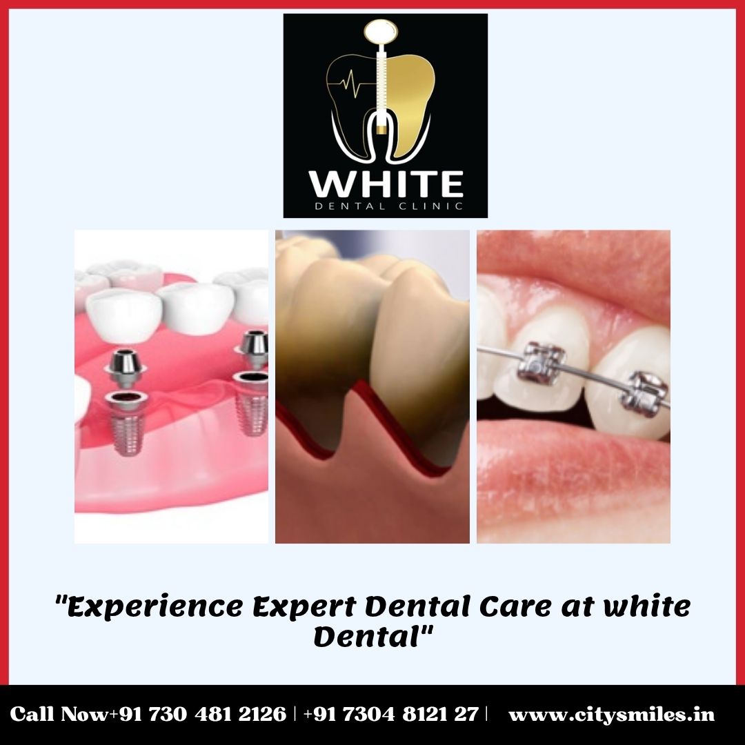  Healthy Smiles Begin at White Dental Clinic! 